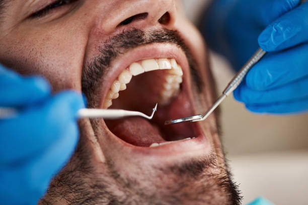 Full Mouth Reconstruction in Federalsburg, MD